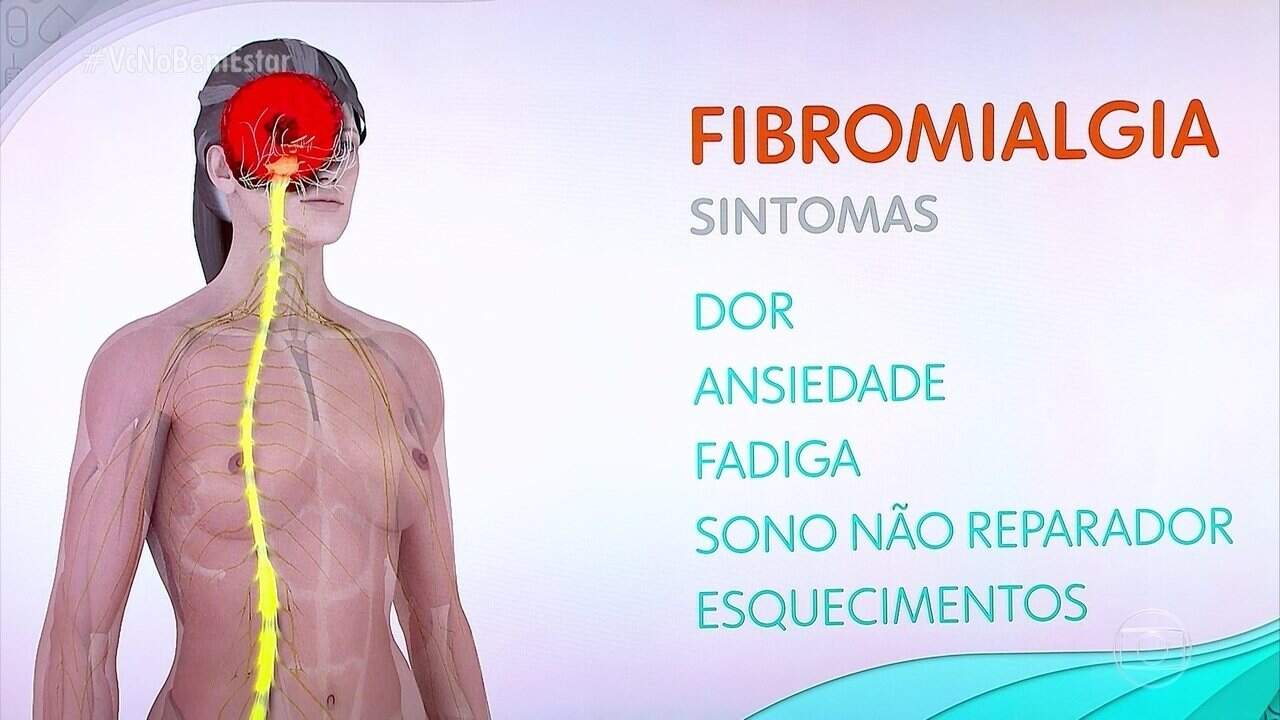 Fibromialgia é a maior causa de dor crônica generalizada no Brasil