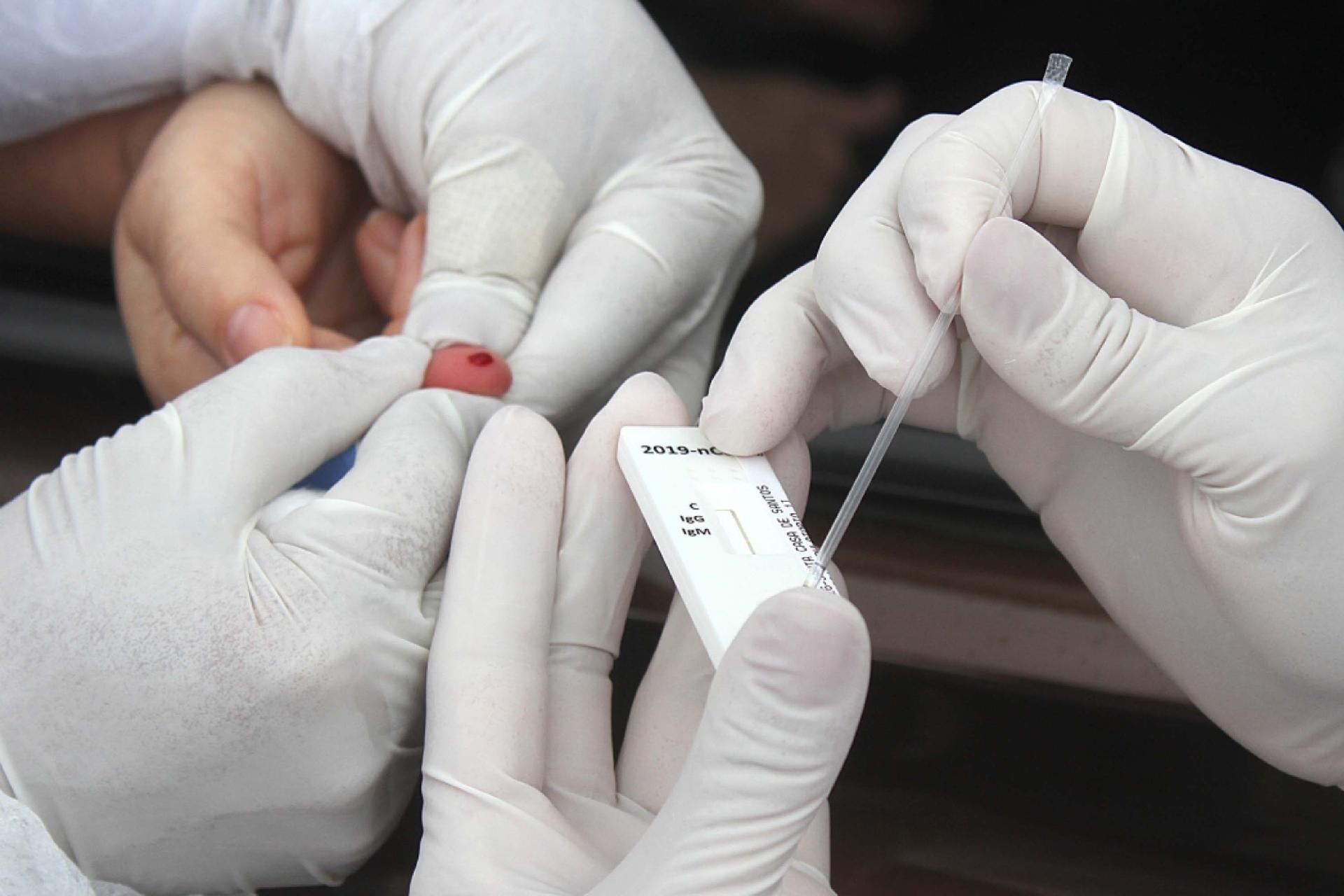 Shopping da Zona Sul de SP lança “drive-thru” para exames de COVID-19