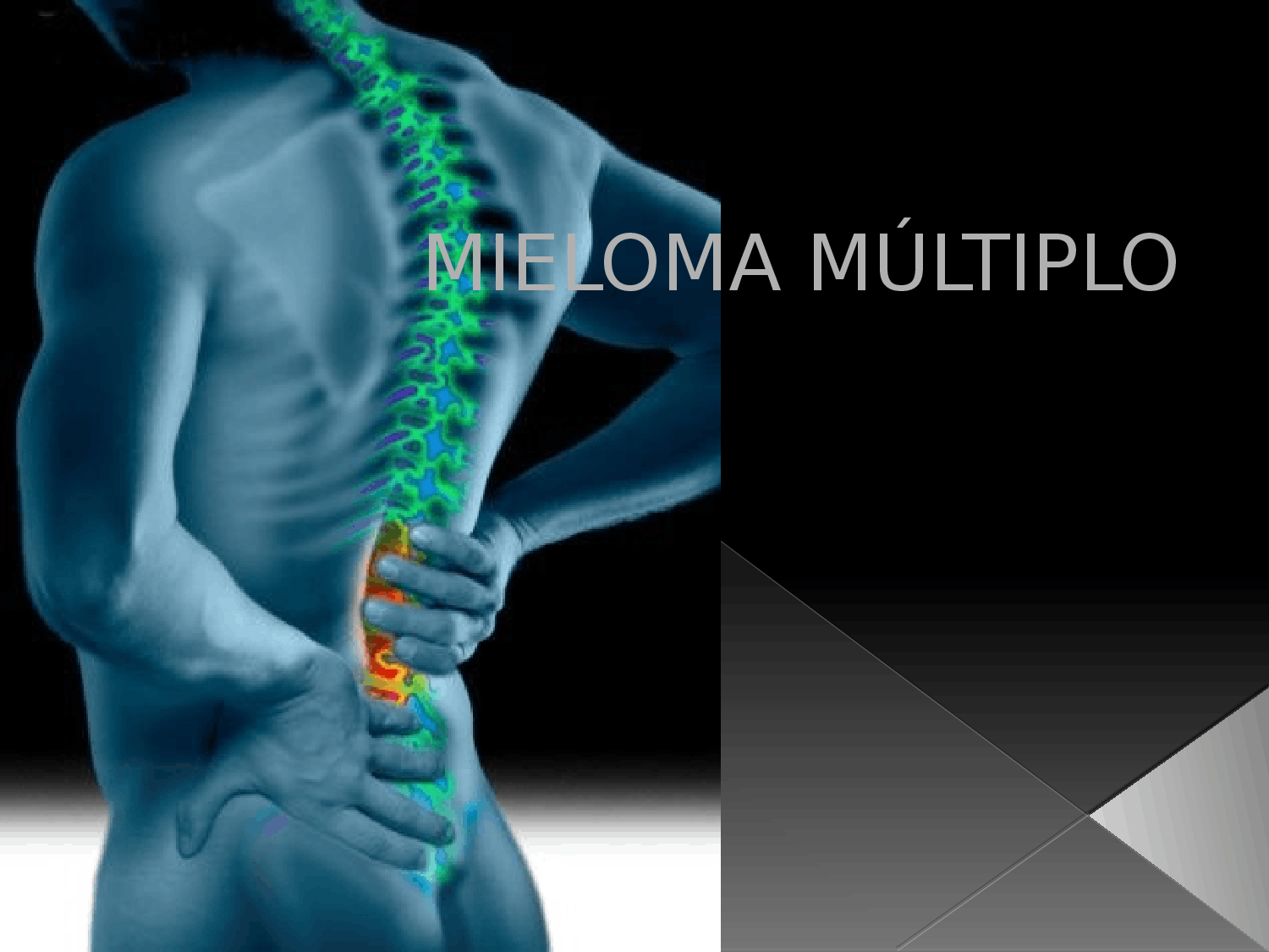 Medicamento para tratamento de mieloma múltiplo, Bortezomibe entra para o rol oferecido pelo SUS